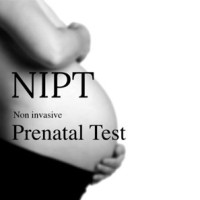 L’implantation du Test Prénatal Non-Invasif au sein du système de soins de santé québécois: considérations éthiques, sociales et politiques /home/lecreumo/public html/wp content/uploads/2017/08/nipt