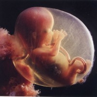 foetus 15semaines