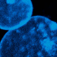 “Ethical and Social Implications of Clinical Implementation of cffDNA Prenatal Screening in North America: a Comparison Between the United States and Canada” /home/lecreumo/public html/wp content/uploads/2017/06/genomics