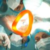 Now try to sleep. Low angle of professional surgeons giving to patient a general anesthetic before an operation. They are holding the equipment and surgical instruments
