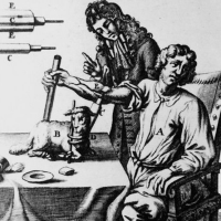 Xenotransplantation
